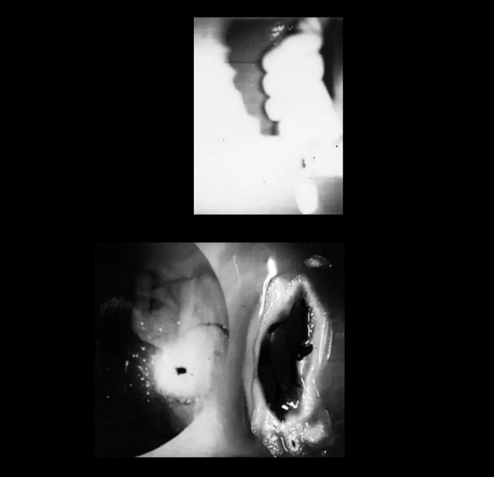 Burning Me 2